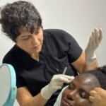 Afro Hair Transplant