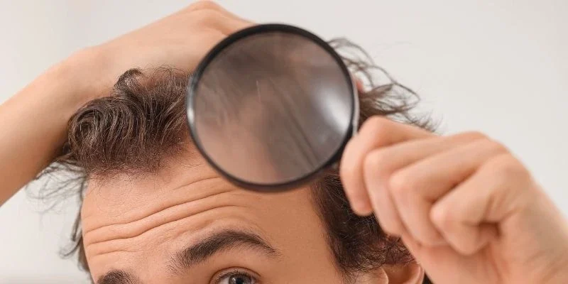 Top Hair Loss Treatments