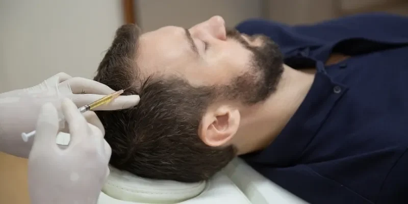PRP Mesotherapy for Hair Loss